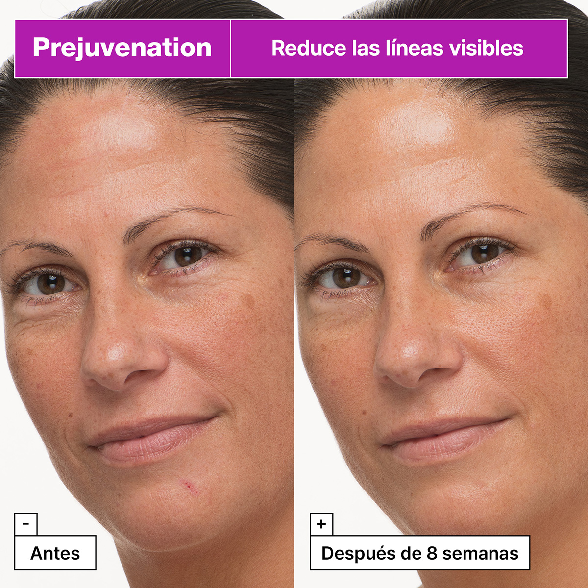 PREJUVENATION FIRMING BAKUCHIOL CREAM (CREMA PARA EL ENVEJECIMIENTO PREVENTIVO)